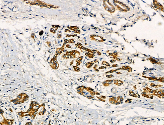 TNFAIP8 Antibody in Immunohistochemistry (Paraffin) (IHC (P))