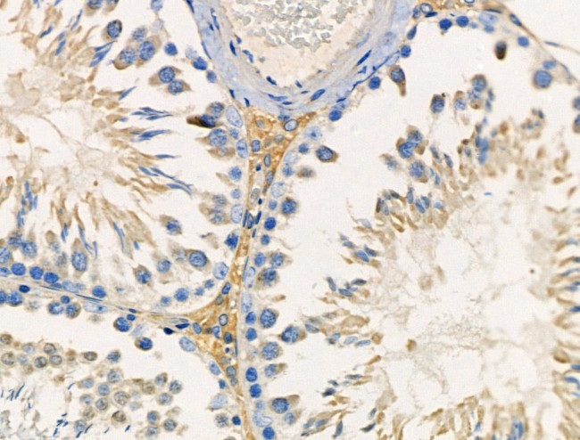 TNFAIP8 Antibody in Immunohistochemistry (Paraffin) (IHC (P))
