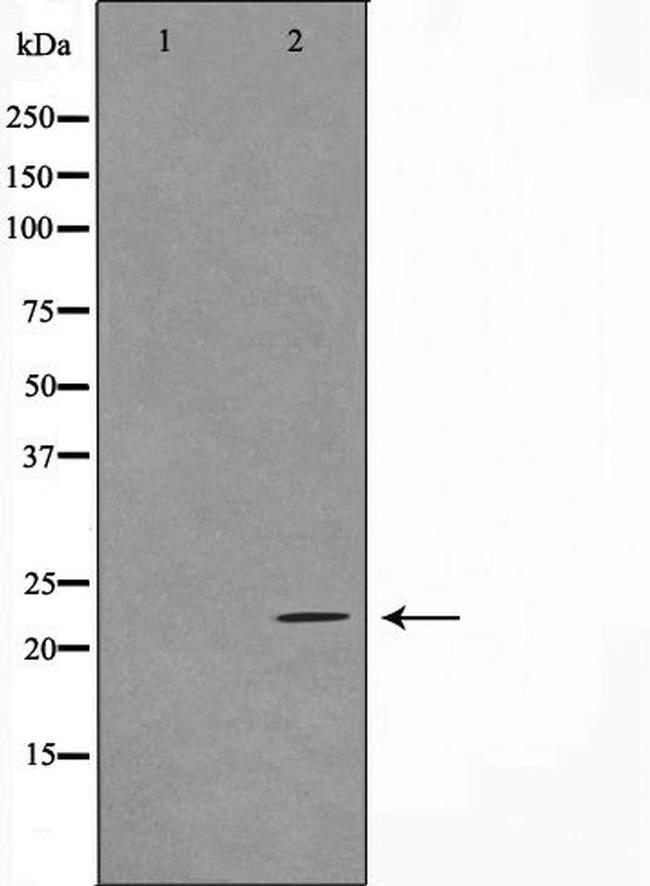 TNFAIP8 Antibody in Western Blot (WB)