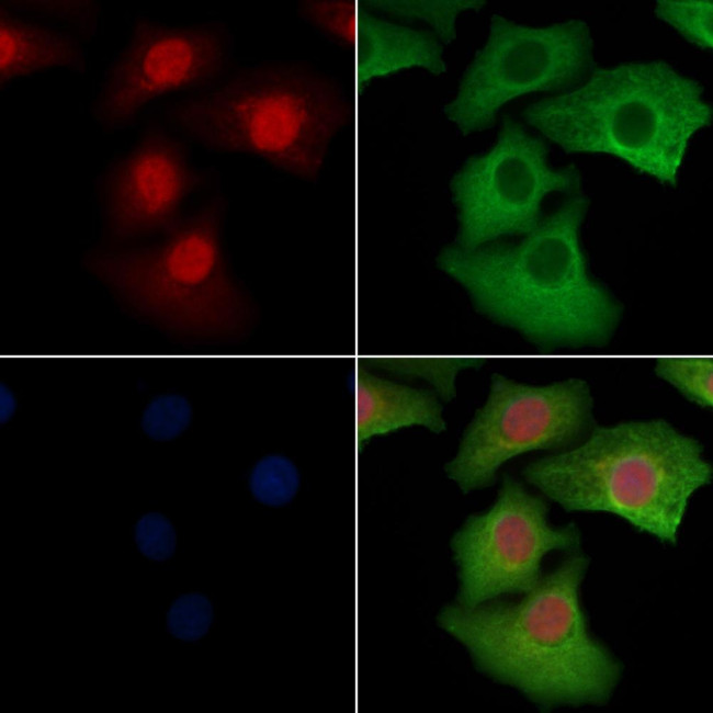 Phospho-ERK1/ERK2 (Thr202, Tyr204) Antibody in Immunocytochemistry (ICC/IF)