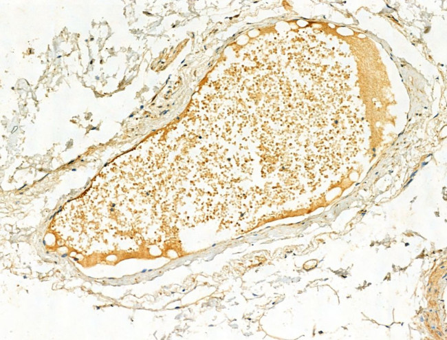 Phospho-ERK1/ERK2 (Thr202, Tyr204) Antibody in Immunohistochemistry (Paraffin) (IHC (P))