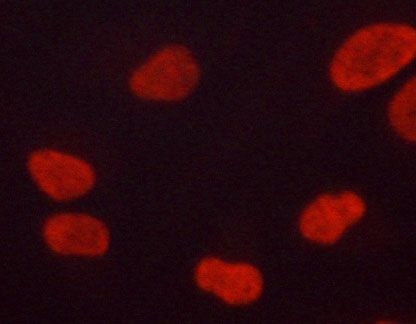 Phospho-ERK1/ERK2 (Thr202, Tyr204) Antibody in Immunocytochemistry (ICC/IF)