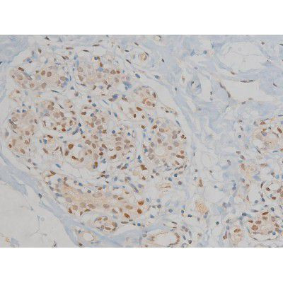 Phospho-ERK1/ERK2 (Thr202, Tyr204) Antibody in Immunohistochemistry (Paraffin) (IHC (P))