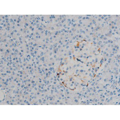 Phospho-ERK1/ERK2 (Thr202, Tyr204) Antibody in Immunohistochemistry (Paraffin) (IHC (P))