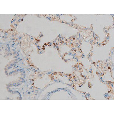 Phospho-ERK1/ERK2 (Thr202, Tyr204) Antibody in Immunohistochemistry (Paraffin) (IHC (P))