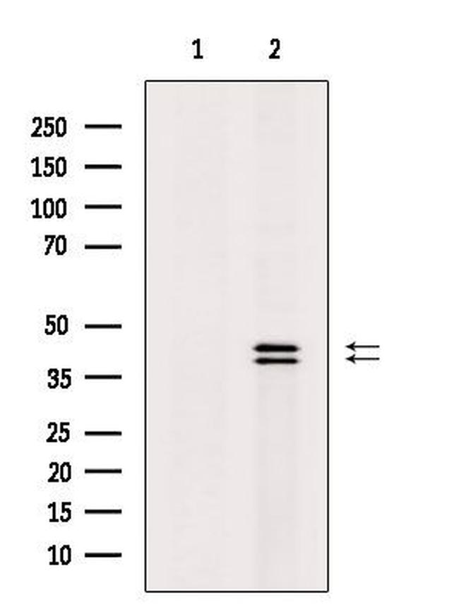 Phospho-ERK1/ERK2 (Thr202, Tyr204) Antibody in Western Blot (WB)