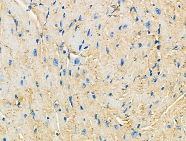 CCR7 Antibody in Immunohistochemistry (Paraffin) (IHC (P))