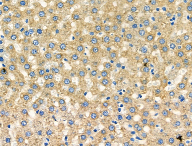 CCR7 Antibody in Immunohistochemistry (Paraffin) (IHC (P))