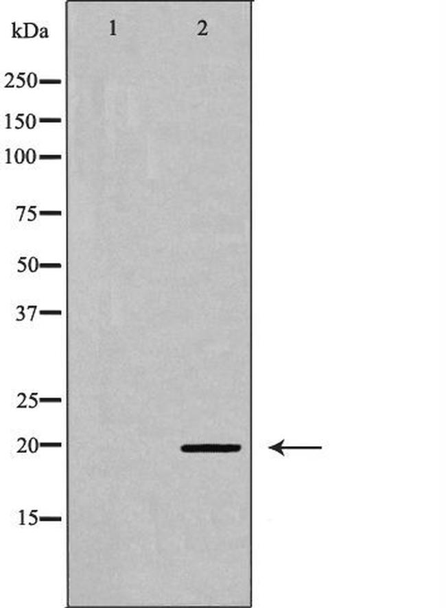 Phospho-MYL9 (Ser19) Antibody in Western Blot (WB)