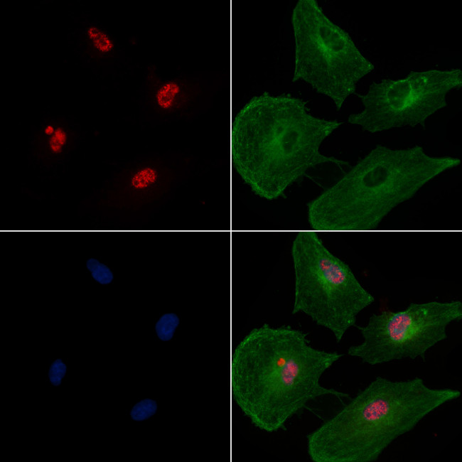 FOXO1/FOXO3/FOXO4 Antibody in Immunocytochemistry (ICC/IF)