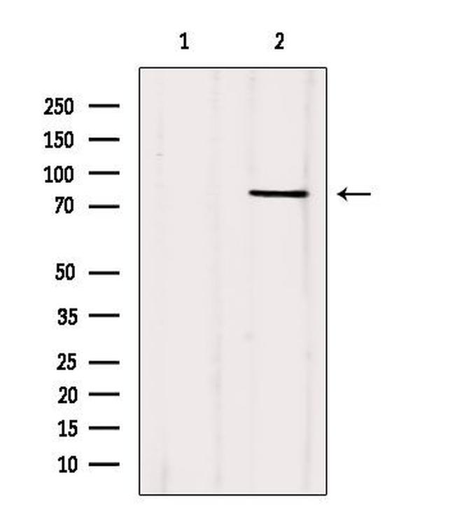 FOXO1/FOXO3/FOXO4 Antibody in Western Blot (WB)