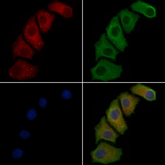 PLA1A Antibody in Immunocytochemistry (ICC/IF)