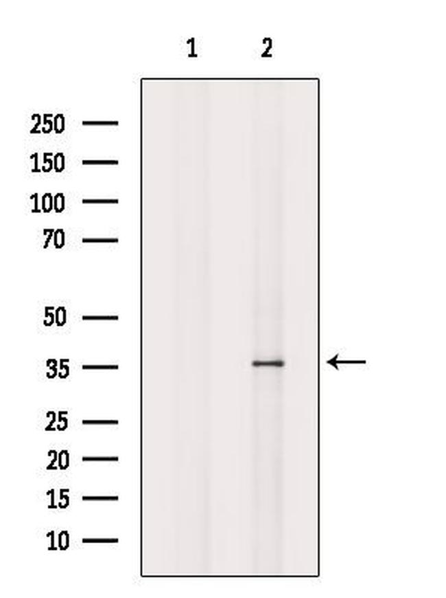 VN1R3 Antibody in Western Blot (WB)