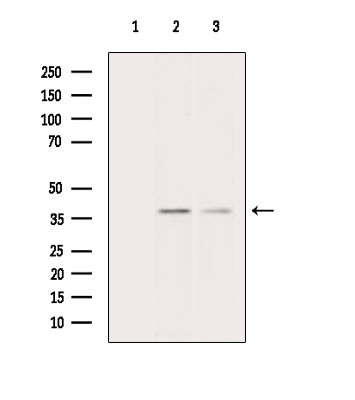CEACAM8 Antibody in Western Blot (WB)