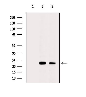 CDO1 Antibody in Western Blot (WB)