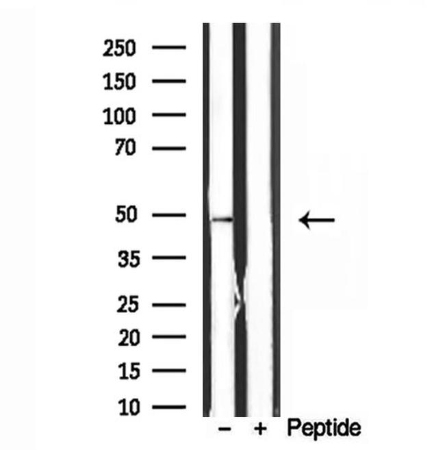 ATP Synthase beta Antibody in Western Blot (WB)