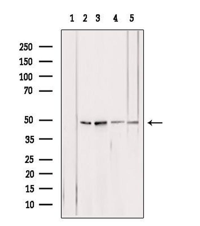 ATP Synthase beta Antibody in Western Blot (WB)