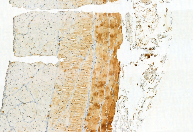 ATP Synthase beta Antibody in Immunohistochemistry (Paraffin) (IHC (P))