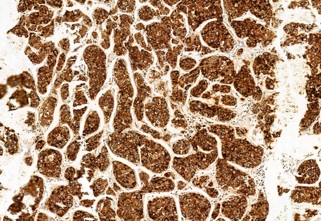 ATP Synthase beta Antibody in Immunohistochemistry (Paraffin) (IHC (P))