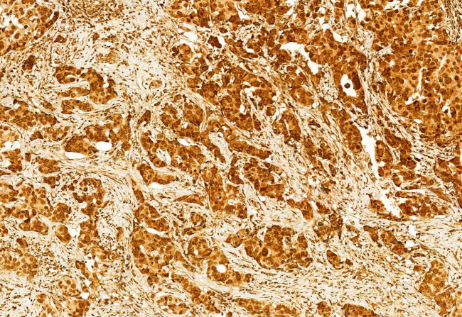 GSDMD Antibody in Immunohistochemistry (Paraffin) (IHC (P))