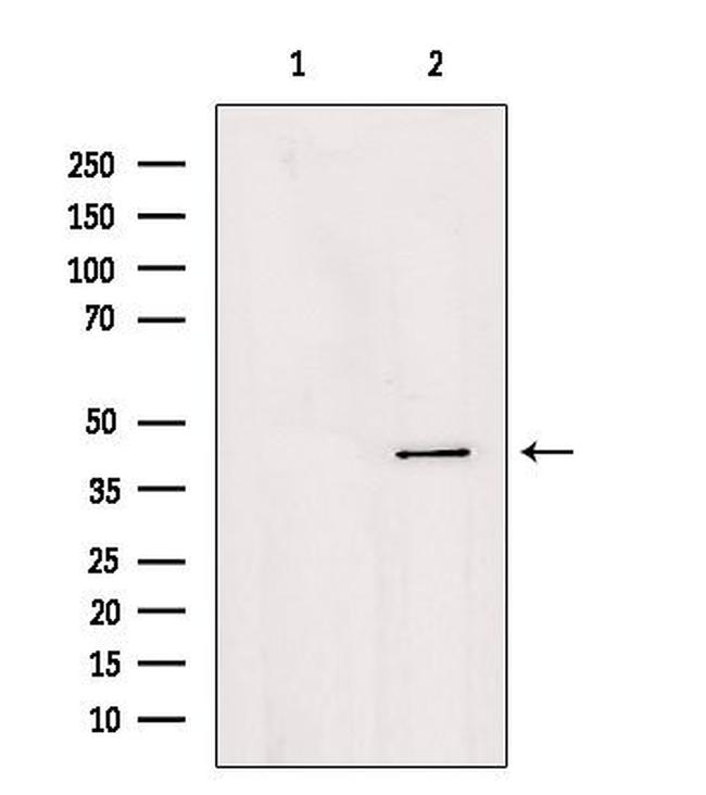 AGPAT4 Antibody in Western Blot (WB)