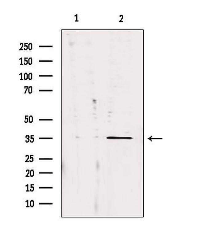 CA13 Antibody in Western Blot (WB)