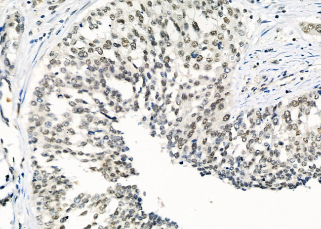 CA13 Antibody in Immunohistochemistry (Paraffin) (IHC (P))