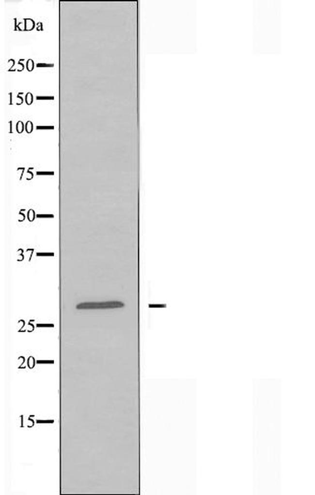 PEX11B Antibody in Western Blot (WB)