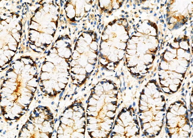 XPB Antibody in Immunohistochemistry (Paraffin) (IHC (P))