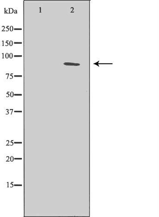 XPB Antibody in Western Blot (WB)