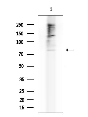 ABCG8 Antibody in Western Blot (WB)