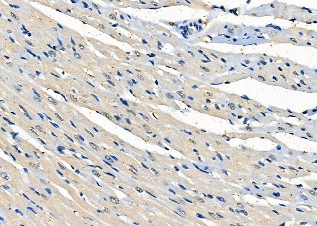 CRTC3 Antibody in Immunohistochemistry (Paraffin) (IHC (P))