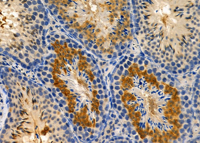 CLASRP Antibody in Immunohistochemistry (Paraffin) (IHC (P))