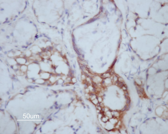 MMP14 Antibody in Immunohistochemistry (Paraffin) (IHC (P))