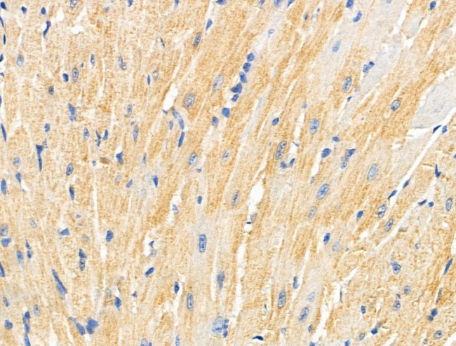 MMP14 Antibody in Immunohistochemistry (Paraffin) (IHC (P))