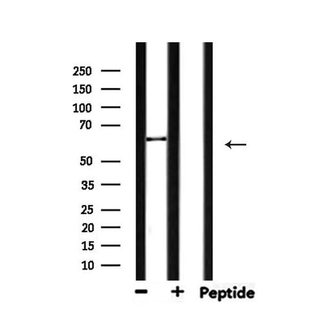 MMP14 Antibody in Western Blot (WB)