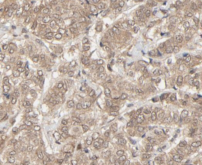 NEDD8 Antibody in Immunohistochemistry (Paraffin) (IHC (P))