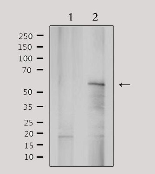 YTHDF1 Antibody in Western Blot (WB)