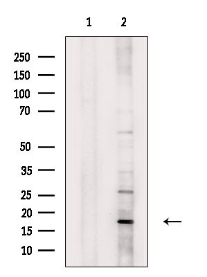 ECRG4 Antibody in Western Blot (WB)