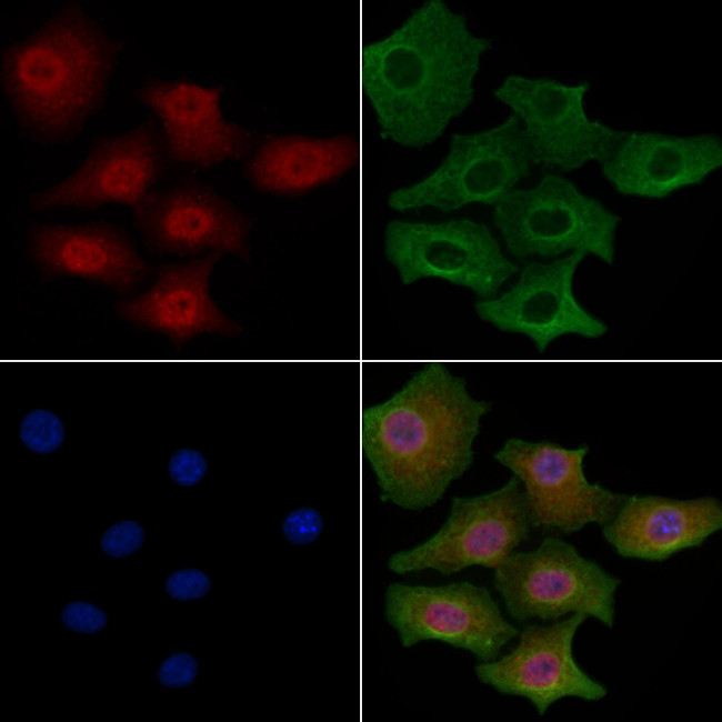 CKS2 Antibody in Immunocytochemistry (ICC/IF)