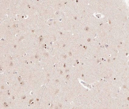 CKS2 Antibody in Immunohistochemistry (Paraffin) (IHC (P))