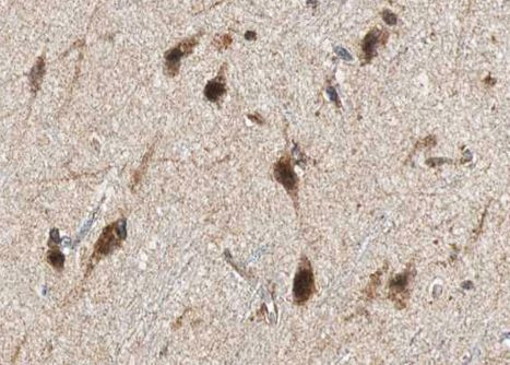 GAD65/GAD67 Antibody in Immunohistochemistry (Paraffin) (IHC (P))