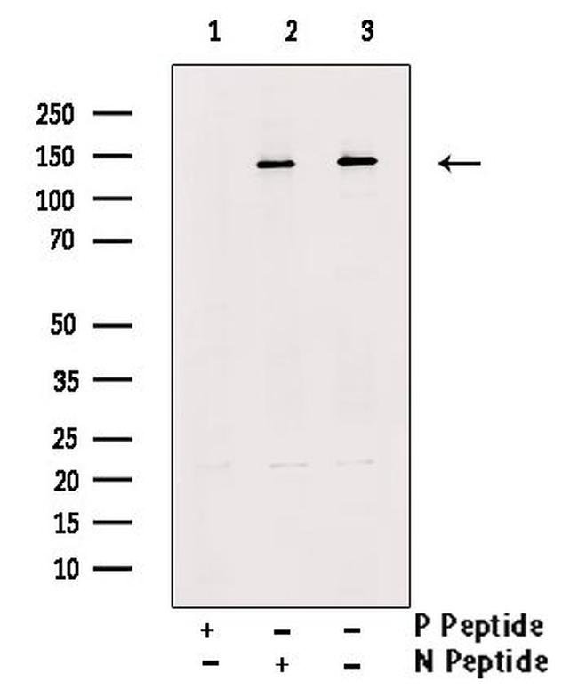 Phospho-ULK1 (Ser317) Antibody in Western Blot (WB)