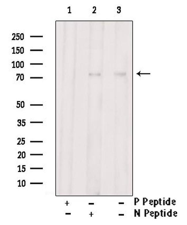 Phospho-GRK2 (Ser29) Antibody in Western Blot (WB)