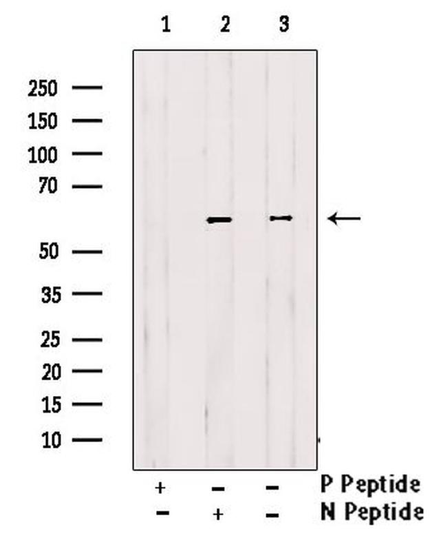 Phospho-Cdc25B (Ser151) Antibody in Western Blot (WB)