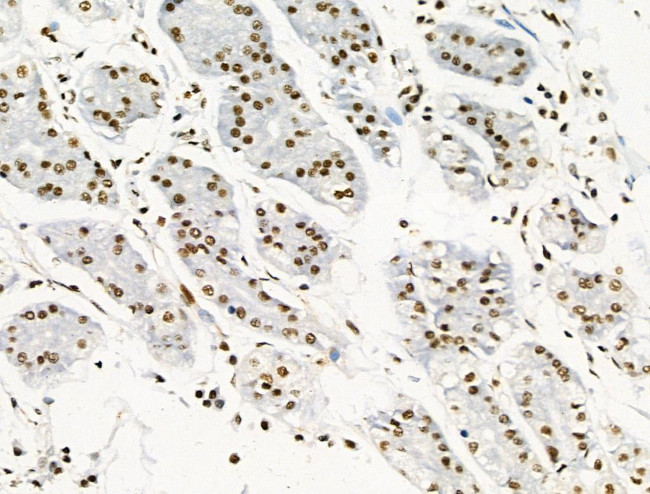 Phospho-RUNX1 (Ser249) Antibody in Immunohistochemistry (Paraffin) (IHC (P))