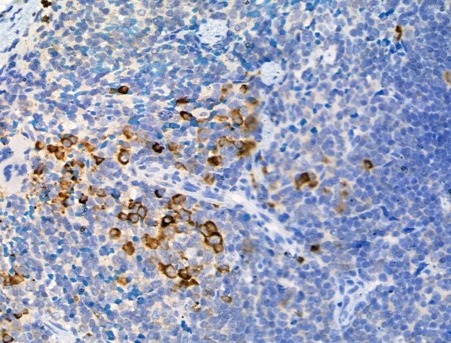 Phospho-ATG13 (Ser355) Antibody in Immunohistochemistry (Paraffin) (IHC (P))