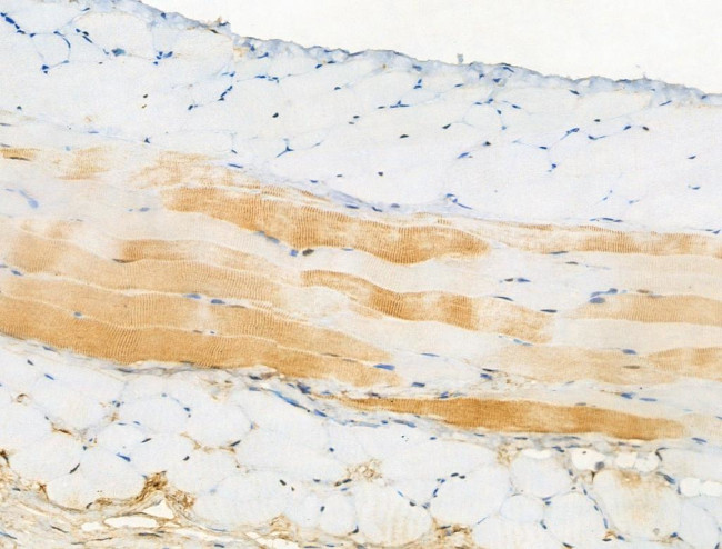 Phospho-ATG14 (Ser29) Antibody in Immunohistochemistry (Paraffin) (IHC (P))