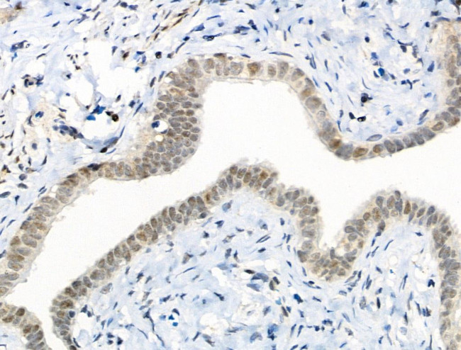 Phospho-CENPA (Ser7) Antibody in Immunohistochemistry (Paraffin) (IHC (P))