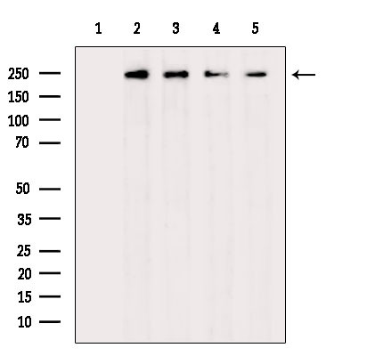 Phospho-EIF4G1 (Ser1147) Antibody in Western Blot (WB)